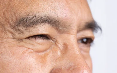 Eye Twitching: Why It Happens and When to See a Doctor